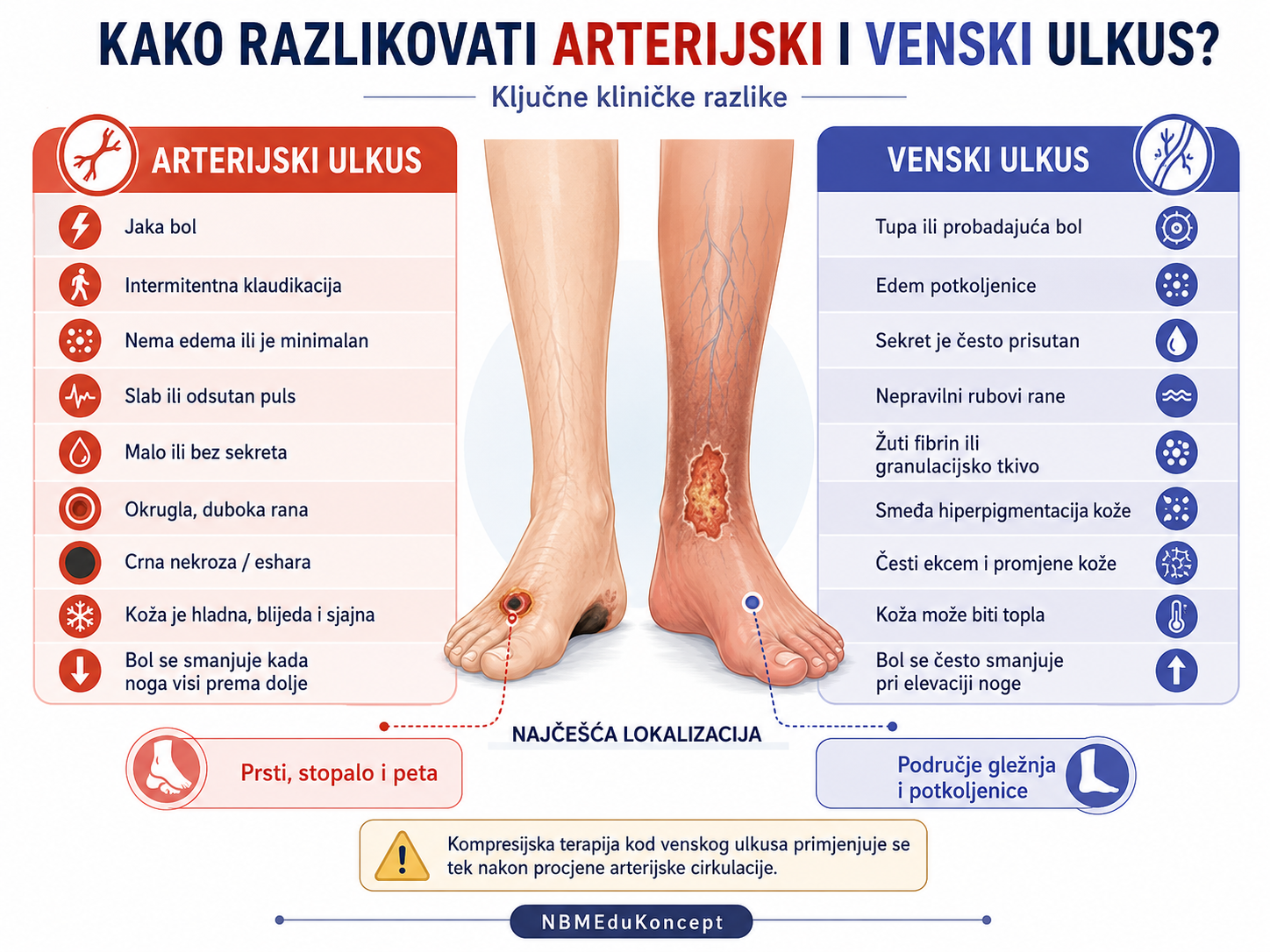 Arterijski i venski ulkus -  diferencijacija