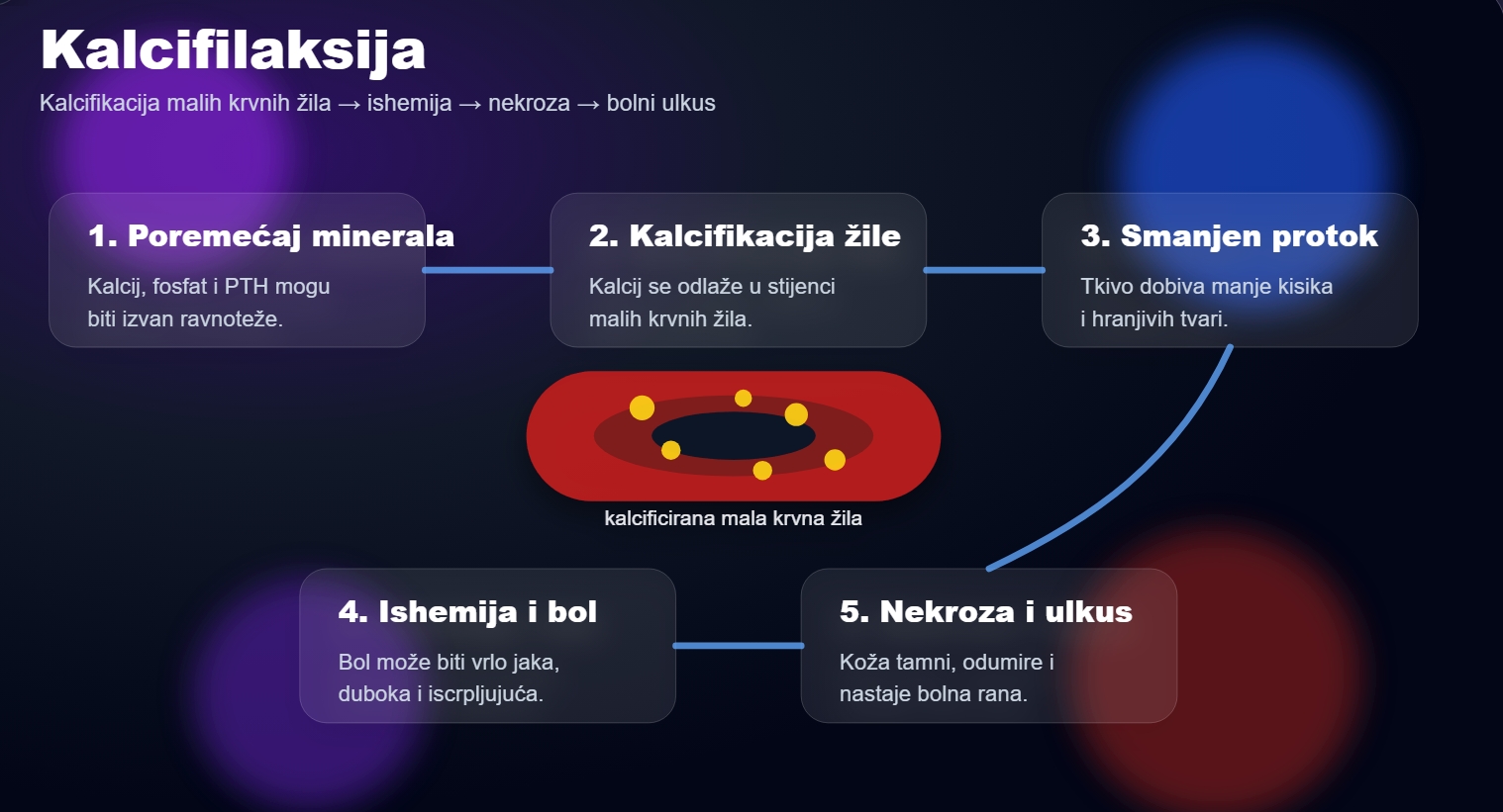 Kalcifilaksija / calciphylaxis - Atipična rana